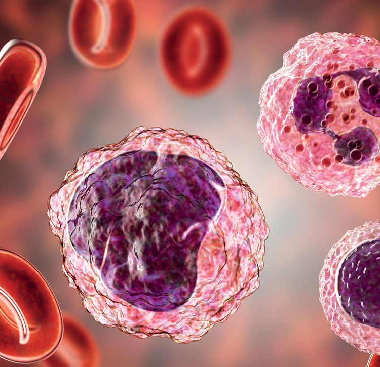 Chronic Myeloid Leukemia (CML)